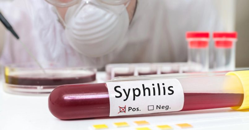 В Латвии бьют тревогу из-за роста случаев заболевания сифилисом