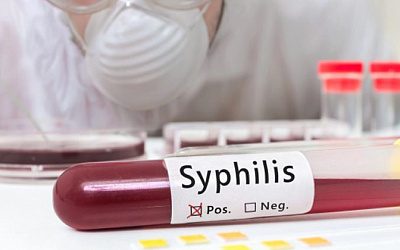 В Латвии бьют тревогу из-за роста случаев заболевания сифилисом